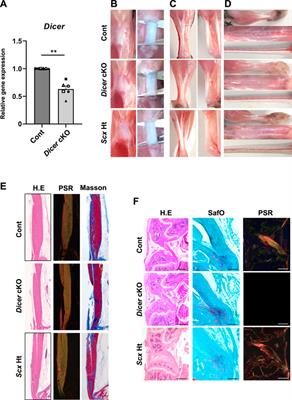 Tendon-Specific Dicer Deficient Mice Exhibit Hypoplastic Tendon Through the Downregulation of Tendon-Related Genes and MicroRNAs